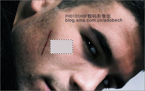 Photoshop制作人物面部伤口缝合的标签